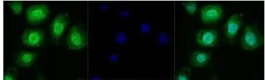Anti-TRPM2 antibody used in Immunocytochemistry/ Immunofluorescence (ICC/IF). GTX04802