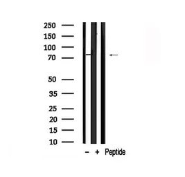 Anti-FOXM1 antibody used in Western Blot (WB). GTX04803