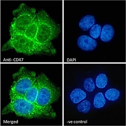 Anti-CD47 antibody used in Immunocytochemistry/ Immunofluorescence (ICC/IF). GTX04816