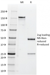 Anti-CD47 antibody [B6H12.2] used in  (). GTX04817