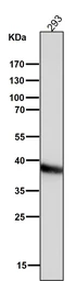 Anti-CDX2 antibody [AFA-3] used in Western Blot (WB). GTX04824