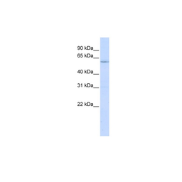 Anti-LRRC15 antibody used in Western Blot (WB). GTX04827
