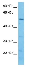 Anti-LRRC15 antibody used in Western Blot (WB). GTX04827