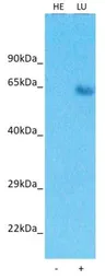 Anti-LRRC15 antibody used in Western Blot (WB). GTX04827