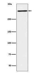 Anti-Reelin antibody [ACFE-18] used in Western Blot (WB). GTX04830