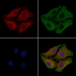 Anti-ZDHHC20 antibody used in Immunocytochemistry/ Immunofluorescence (ICC/IF). GTX04833