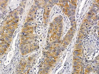 Anti-ZDHHC20 antibody used in IHC (Paraffin sections) (IHC-P). GTX04833
