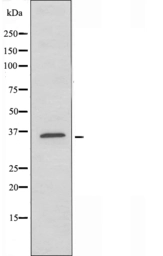 Anti-ZDHHC20 antibody used in Western Blot (WB). GTX04833