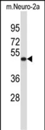 Anti-VAT1L antibody used in Western Blot (WB). GTX04839