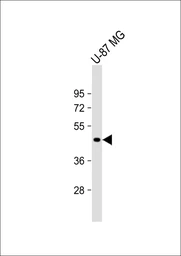 Anti-VAT1L antibody used in Western Blot (WB). GTX04839