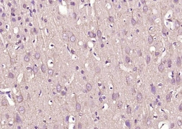 Anti-VAT1L antibody used in IHC (Paraffin sections) (IHC-P). GTX04840