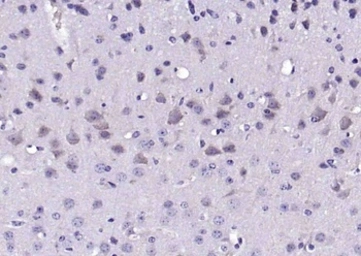 Anti-VAT1L antibody used in IHC (Paraffin sections) (IHC-P). GTX04840