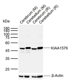 Anti-VAT1L antibody used in Western Blot (WB). GTX04840