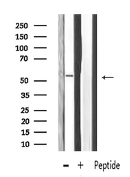 Anti-MMP13 antibody used in Western Blot (WB). GTX04845