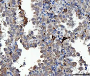 Anti-SEPT9 antibody used in IHC (Paraffin sections) (IHC-P). GTX04846