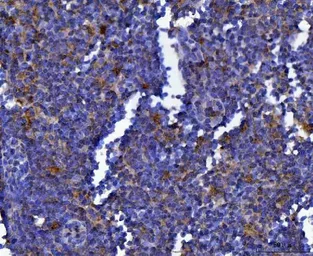 Anti-SEPT9 antibody used in IHC (Paraffin sections) (IHC-P). GTX04846