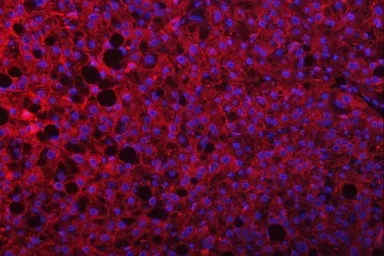 Anti-SEPT9 antibody used in IHC (Paraffin sections) (IHC-P). GTX04846