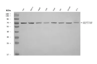 Anti-SEPT9 antibody used in Western Blot (WB). GTX04846