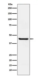 Anti-Septin 2 antibody [18S62] used in Western Blot (WB). GTX04847