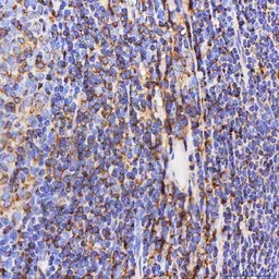 Anti-SEPT6 antibody used in IHC (Paraffin sections) (IHC-P). GTX04848
