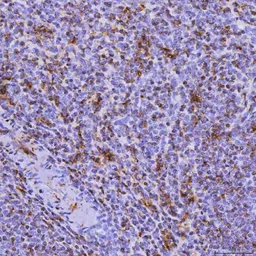 Anti-SEPT6 antibody used in IHC (Paraffin sections) (IHC-P). GTX04848