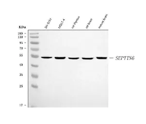 Anti-SEPT6 antibody used in Western Blot (WB). GTX04848