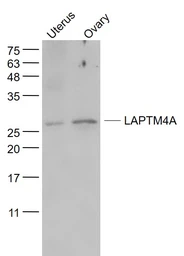 Anti-LAPTM4A antibody used in Western Blot (WB). GTX04850