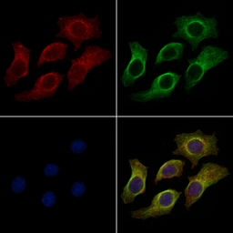 Anti-HLA Class I antibody used in Immunocytochemistry/ Immunofluorescence (ICC/IF). GTX04853