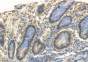 Anti-HLA Class I antibody used in IHC (Paraffin sections) (IHC-P). GTX04853