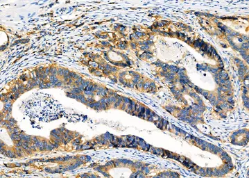 Anti-HLA Class I antibody used in IHC (Paraffin sections) (IHC-P). GTX04853