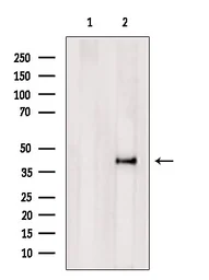 Anti-HLA Class I antibody used in Western Blot (WB). GTX04853