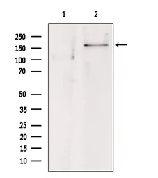 Anti-SUR1 antibody used in Western Blot (WB). GTX04854