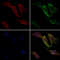 Anti-SUR1 antibody used in Immunocytochemistry/ Immunofluorescence (ICC/IF). GTX04854