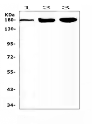 Anti-SUR1 antibody used in Western Blot (WB). GTX04855