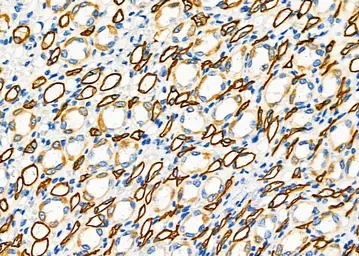 Anti-FGF21 antibody used in IHC (Paraffin sections) (IHC-P). GTX04856