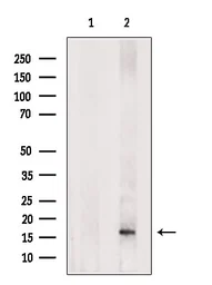 Anti-FGF21 antibody used in Western Blot (WB). GTX04856