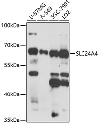 Anti-SLC24A4 antibody used in Western Blot (WB). GTX04857