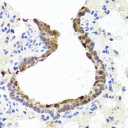 Anti-TOPBP1 antibody used in IHC (Paraffin sections) (IHC-P). GTX04859