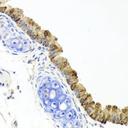 Anti-TOPBP1 antibody used in IHC (Paraffin sections) (IHC-P). GTX04859