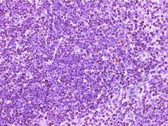 Anti-CD4 antibody used in IHC (Paraffin sections) (IHC-P). GTX04861