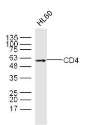 Anti-CD4 antibody used in Western Blot (WB). GTX04861