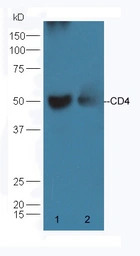 Anti-CD4 antibody used in Western Blot (WB). GTX04861
