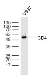 Anti-CD4 antibody used in Western Blot (WB). GTX04861