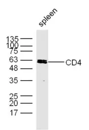Anti-CD4 antibody used in Western Blot (WB). GTX04861
