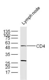 Anti-CD4 antibody used in Western Blot (WB). GTX04861