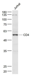 Anti-CD4 antibody used in Western Blot (WB). GTX04861