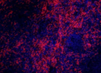 Anti-CD8 alpha antibody used in IHC (Paraffin sections) (IHC-P). GTX04862