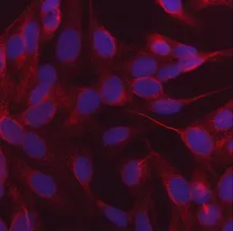 Anti-NDP52 antibody [9E2F2] used in Immunocytochemistry/ Immunofluorescence (ICC/IF). GTX04863