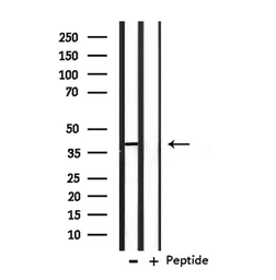 Anti-OPCML antibody used in Western Blot (WB). GTX04869