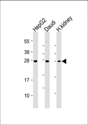 Anti-TIM-3 antibody [1827CT151.74.68] used in Western Blot (WB). GTX04870